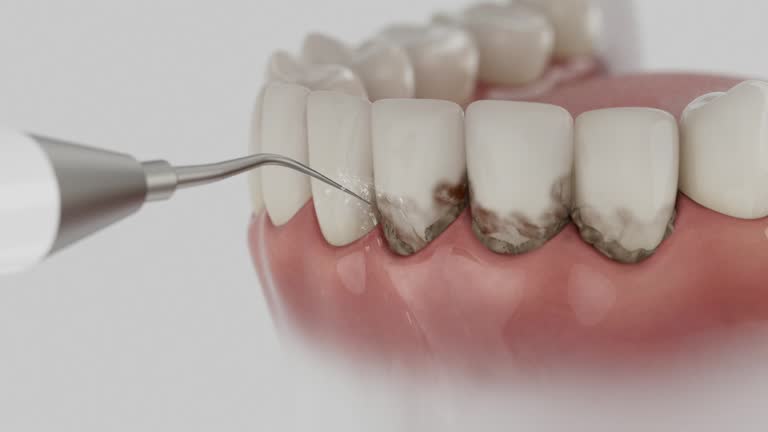 Trusted Tooth Extraction service in Fort Myers Shores, FL - Dentist Open Now